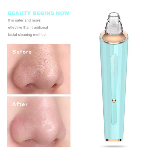 جهاز ازالة الرؤوس السوداء الذكي - Smart blackhead remover